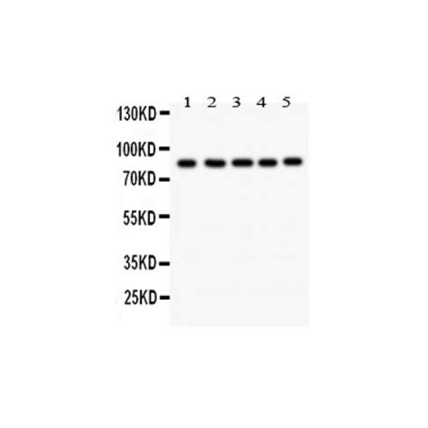 Foxm1 Antibody Novatein Biosciences