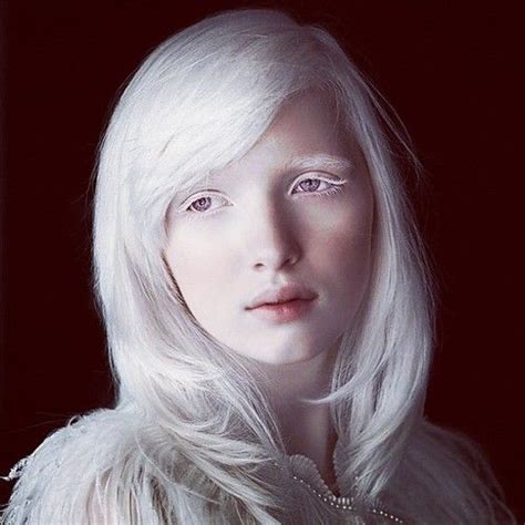 The Most Beautiful Albino Girl In The World Nastya Zhidkova Was Born In Russia Modelo Albino
