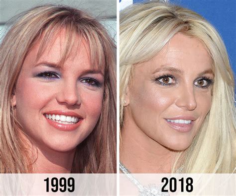 Britney Spears Fans Criticize Her Alleged Nose Job On Instagram