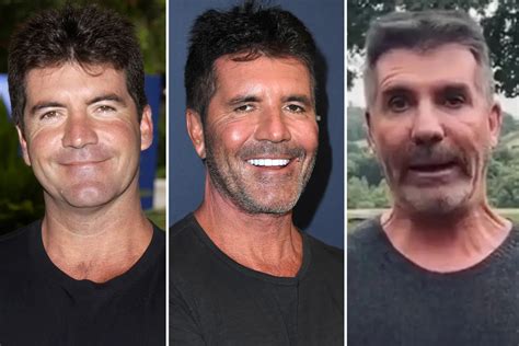 Simon Cowells Face Then And Now See Pictures Of His Transforming