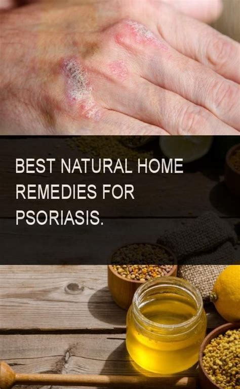 If you're facing this issue, there might be an underlying skin condition or an. Itchy Skin Rash Remedy Natural - NaturalSkins