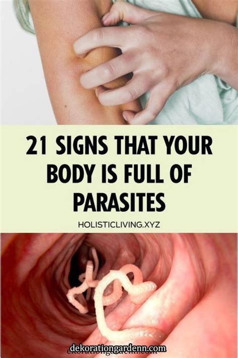 21 Signs That Your Body Is Full Of Parasites Parasite Intestinal