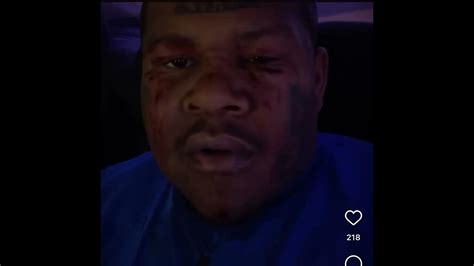 55 Crip Cmac Gets Dped In His Hoodjumped And Beat😳😲 Youtube