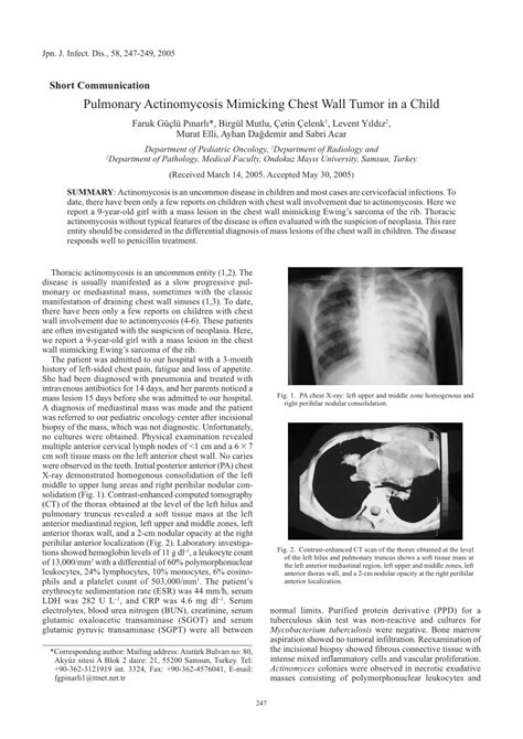 Pdf Pulmonary Actinomycosis Mimicking Chest Wall Tumor In A Child