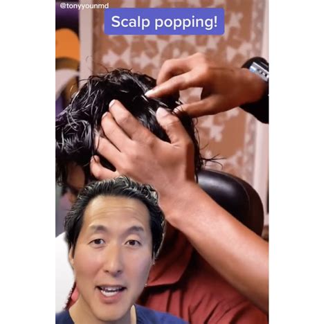 Doctor Warns Against Bizarre And Dangerous Scalp Popping Trend