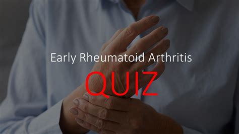 Ra Quiz Can You Identify Early Rheumatoid Arthritis Rheumatology