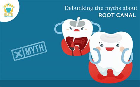 Debunking The Common Myths About Root Canal Treatment Elite Dental Care