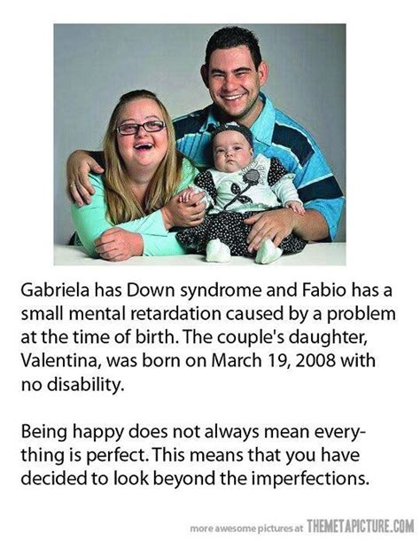 What Does Down Syndrome Mean - SIWHAT gambar png