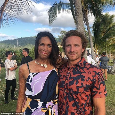 Burns Survivor Turia Pitt Reveals She Has Cut Back On Her Recovery Due