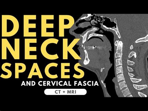 Deep Neck Spaces And Deep Cervical Fascia Anatomy Radiology Anatomy Part Prep Ct And Mri