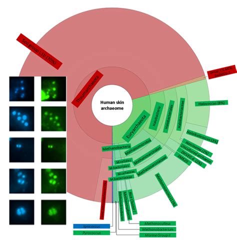 Whats On Your Skin Archaea Thats What Berkeley Lab News Center