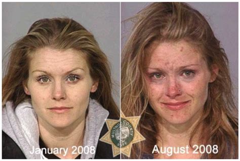 Faces Of Meth How Meth Addiction Affects People