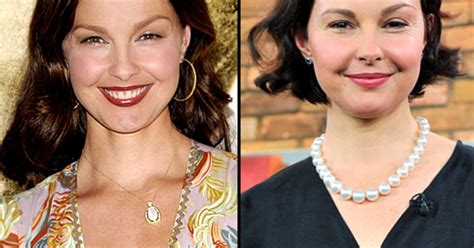 what happened to ashley judd s face us weekly