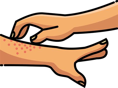 Itchy Arm Clipart Clipart Kid Mosquito Bite Clipart X Clip