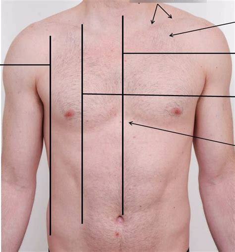 Anterior Chest Wall Diagram Quizlet