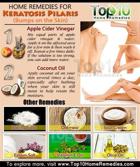 Home Remedies For Keratosis Pilaris Bumps On The Skin Top 10 Home