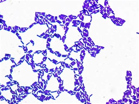 Bacillus Megaterium Gram Staining