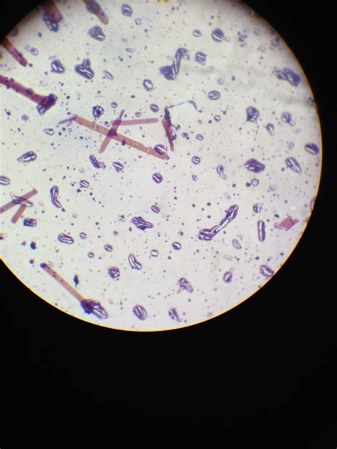 4 Questions With Answers In Gram Positive Rods Science Topic