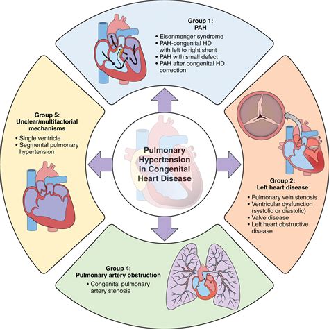 Pulmonary Hypertension In Congenital Heart Disease A Scientific