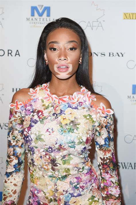 Model Winnie Harlow Says She S Much More Than Her Vitiligo Skin Essence Free Hot Nude Porn Pic