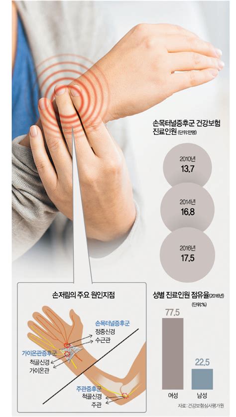손목터널증후군 증상 혈액순환 문제와 다르다 A20