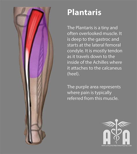 Discusses symptoms such as pain and swelling in back of leg or heel. plantaris | Muscle, Achilles, Intrinsic