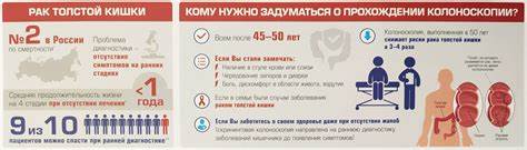 Дивертикулит диета толстой кишки лечение Рак толстой (ободочной) кишки - симптомы и признаки, диагностика Рак толстой (ободочной) кишки - симптомы и признаки, диагностика Дивертикулит диета толстой кишки лечение