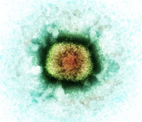 Vaccinia Virus Particle Photograph By Heather Daviesscience Photo Library