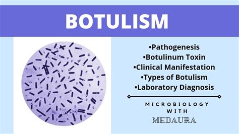 Botulism Clostridium Botulinum Microbiology 2nd Mbbs
