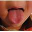 What Is Your Tongue Telling You About Health  Eat Well Enjoy