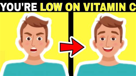 In fact, medical professionals have been debating the efficacy of routine vitamin d screenings and supplementation recommendations for years. Signs You Have Vitamin C Deficiency - YouTube