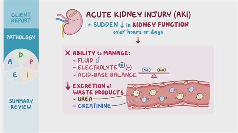 Acute Kidney Injury Aki Nursing Process Adpie Osmosis Video Library