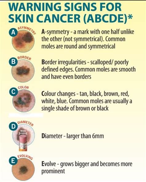 Do A Monthly “spot The Spot” Skin Check Cansa The Cancer