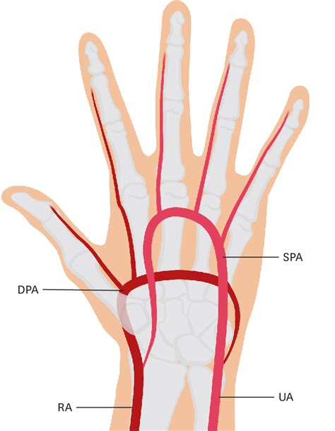 Anatomical Structure Of Left Hand Arteries Dpa Deep Palmar Arch Ra