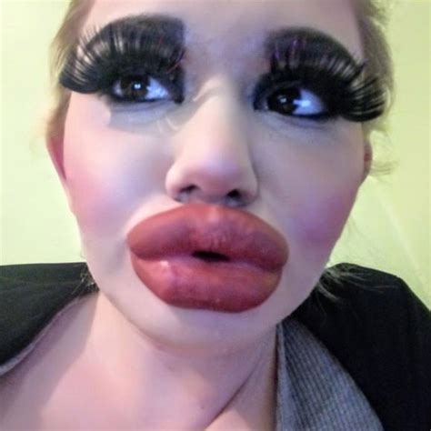 Andrea Ivanova Has Lip Injections To Look Like Idol Barbie The