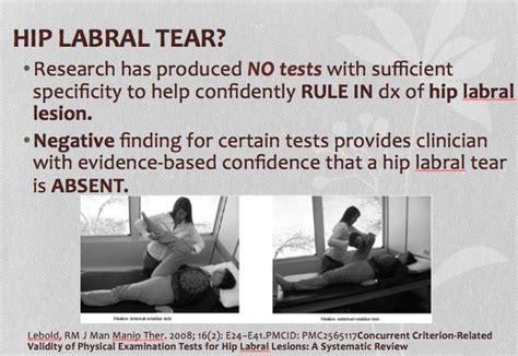Labral Tear Hip Test Change Comin