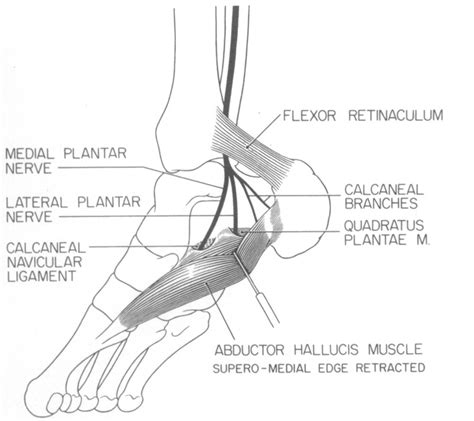 The Tarsal Tunnel Syndrome — Objective Diagnostic Criteria Nejm