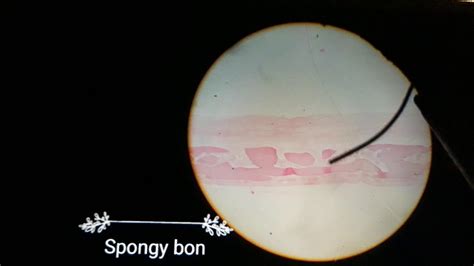 Spongy Bone Histology Youtube