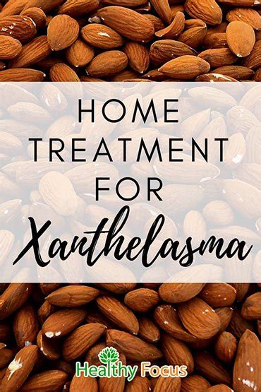 9 Home Remedies For Xanthelasma Healthy Focus