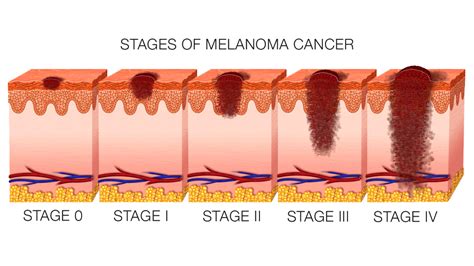 49 Hq Images Cat Cancer Symptoms Skin Six Symptoms Of Feline Skin