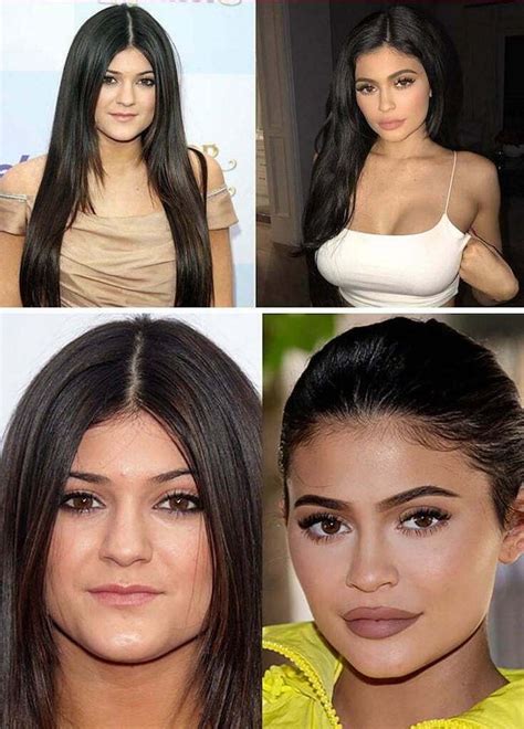 Kylie Jenner I Havent Done Plastic Surgery Celebria Atrl