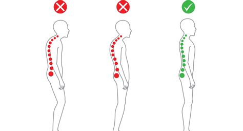 Posture And Ergonomics Archives Ansell Chiropractic Centre