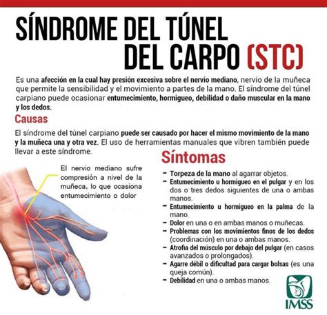 Síndrome Del Túnel Carpiano Prevencionar Perú Prevencionar Perú
