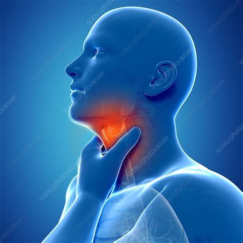 Sore Throat Artwork Stock Image F0076348 Science Photo Library