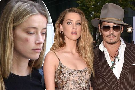 Hóa Ra Johnny Depp Bị Vợ Cũ đánh đập Vtv Vn