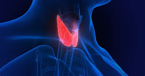 Parathyroid Adenoma Tumors Symptoms Diagnosis And Treatments