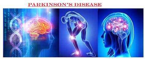 Parkinsons Disease Causes Sign And Symptoms Diagnosis Complication