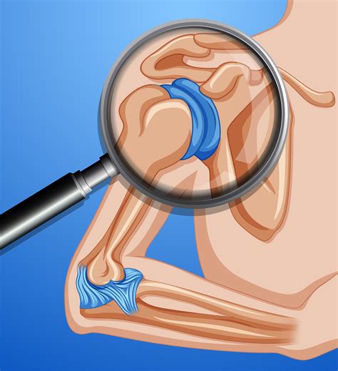 A human shoulder joints 413874 Vector Art at Vecteezy