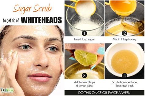 Home Remedies For Whiteheads Whiteheads Homemade Face Masks Simple