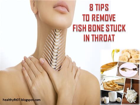 How Do You Remove A Fish Bone From Your Throat 8 Tips To Remove Fish